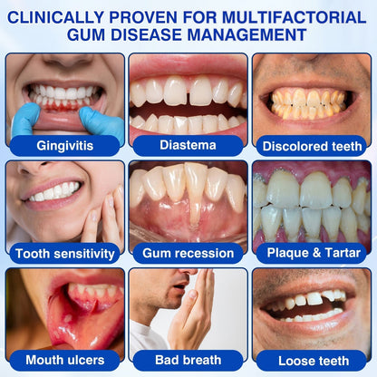 🦷 PERIVA Advanced Gum Care Gel – Tägliche Pflege für frischen Atem & gepflegtes Zahnfleisch