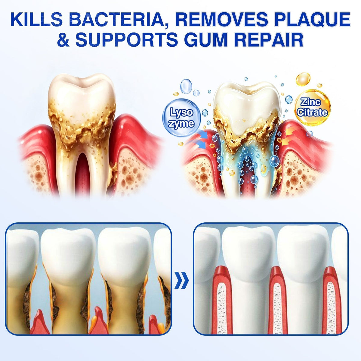 🦷 PERIVA Advanced Gum Care Gel – Tägliche Pflege für frischen Atem & gepflegtes Zahnfleisch