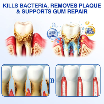 🦷 PERIVA Advanced Gum Care Gel – Tägliche Pflege für frischen Atem & gepflegtes Zahnfleisch