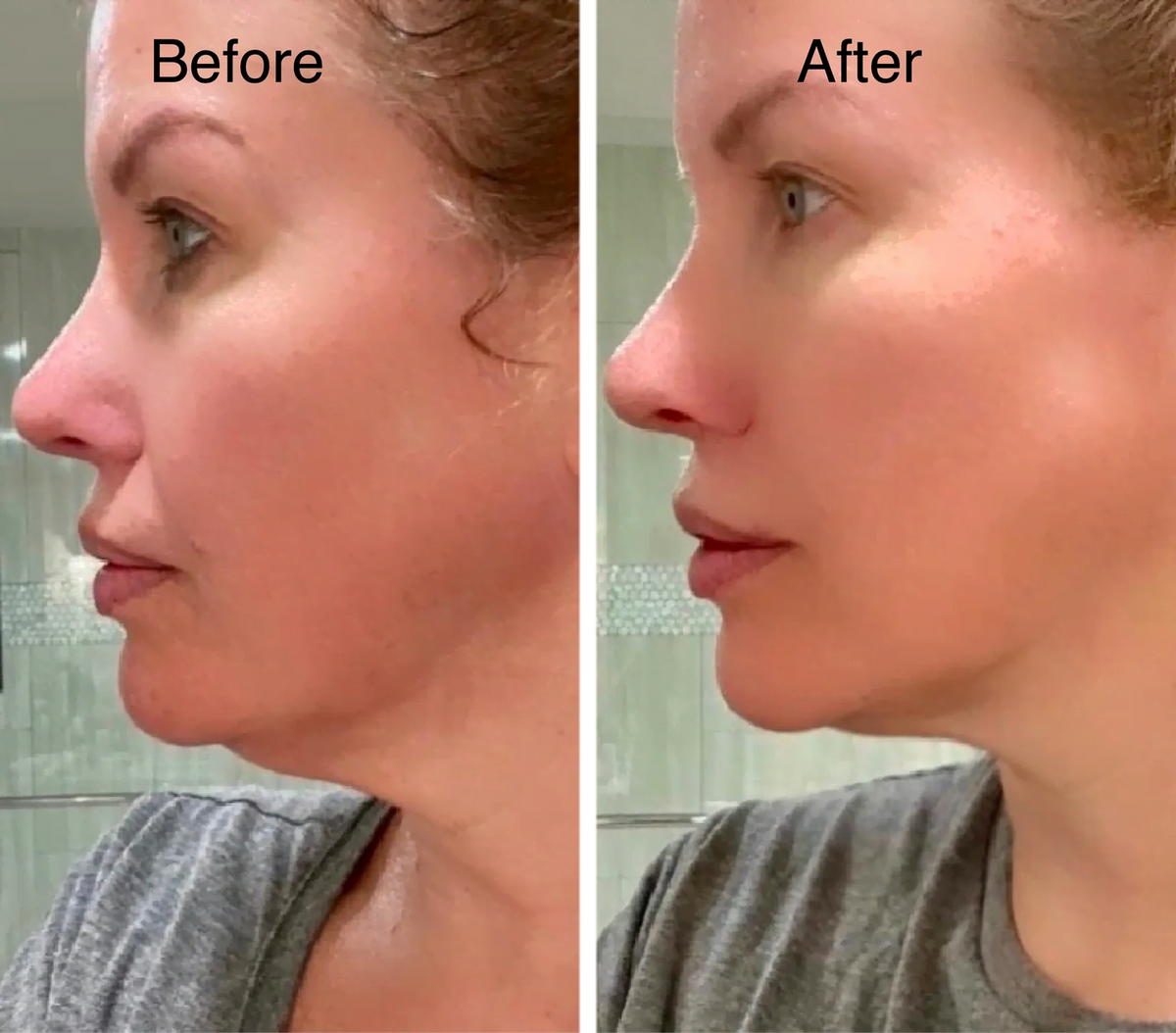 ✨Gesichtskontur- & Lymphmassagebürste