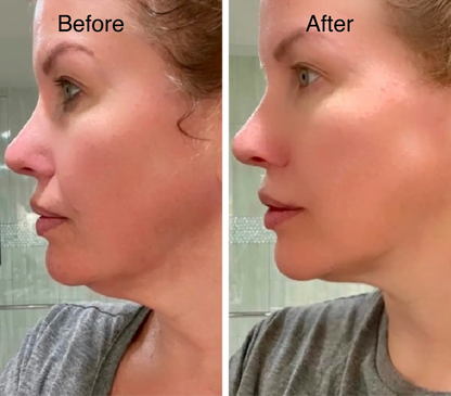 ✨Gesichtskontur- & Lymphmassagebürste